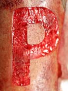 Peeling réalisé sur un Mollet