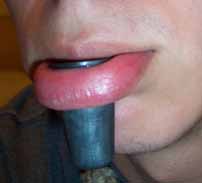 Stretching du Labret